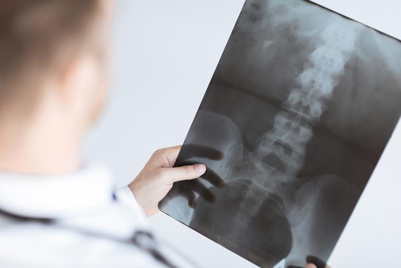 X-Rays  Springtown, TX, 